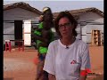 Malnutrition: MSF Campaign for Effective Treatment