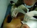 Micro Dermal Anchor Piercing