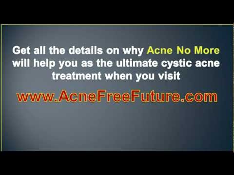 Cystic Acne Treatment – Cure Cystic Acne