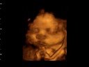Paul   Paulene First Baby part 1 of 2