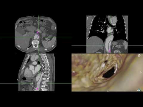 how to repair ct scan machine