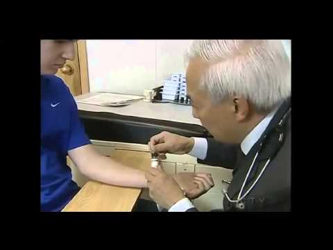how to cure nut allergy