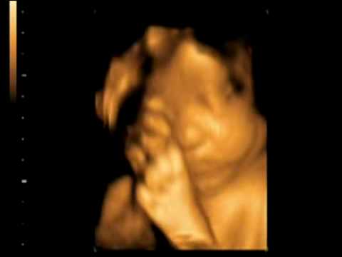 how to self abort a child