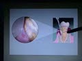 Introduction to Perioscopy