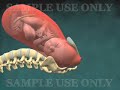 3D Animation Medicale: Naissance vaginale normale avec effac