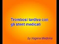 Trombosi tardiva con gli stent medicati