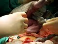 NACIMIENTO DE PALOMITA