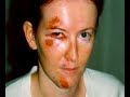 A Video for my best friend Stephanie's project on WAVAW There are alot of pictures and facts on Spousal Abuse. The song is Face Down by Red Jumpsuit Appartatus. this is a school project. not for distribution. DUH! LEAVE COMMENTS! let me know what you think