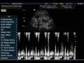 Ultrassom da Heloysa Caroline Pasquali da Silva