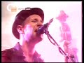 -2-billys-band.html