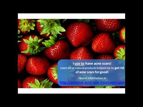 Acne Scar Removal - How To Get Rid Of Acne Scars Naturally