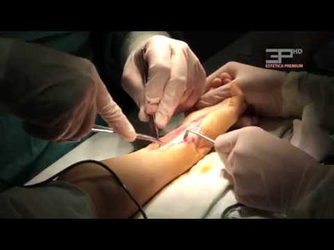Care este diferenta dintre chirurgia plastica pedriatica si cea pentru adulti?