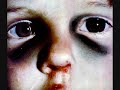 Abuse