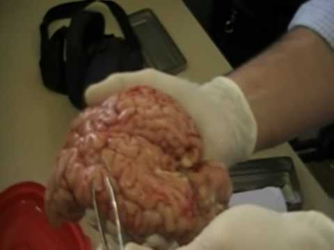 Autopsias+De+Humanos reales de humanos - Videos | Videos relacionados con autopsias reales ...