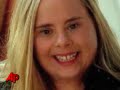 The woman who portrayed a character with Down Syndrome on the Fox animated comedy 