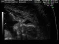 19 weeks pregnant with baby boy Ultrasound