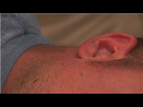 Acupuncture Treatments : Acupuncture Treatment for Tinnitus