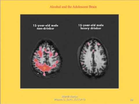 Alcohol and Addiction- How it affects the Brain