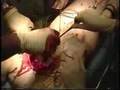 Field eXpedients: Quik-Clot Life Saving Powder-and Now Gauze