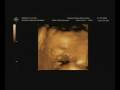 videos de Ethan Emile Clark 28 weeks pregnant