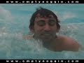 Swimmers Ear Swimmers Ear