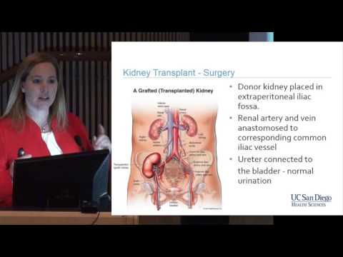how to be a live donor for kidney transplant