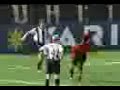 Arbitro spastico