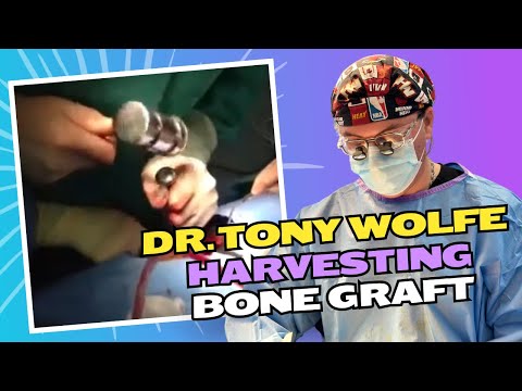 how to harvest iliac bone graft