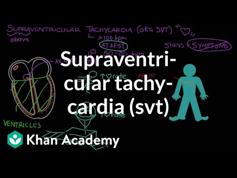 how to cure svt