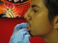 My Brother Gets Snake Bites