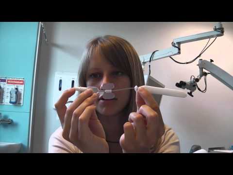 how to treat epistaxis