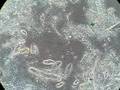 videos de Leaping Protozoa