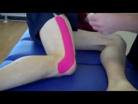 how to cure iliotibial band syndrome