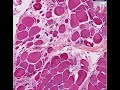 Histopathology Muscle, skeletal--Muscular dystrophy Histopathology Muscle, skeletal--Muscular dystrophy