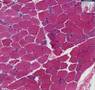 Histopathology Muscle, skeletal--Muscular dystrophy