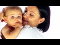 Watch 'Alergia pokarmowa'