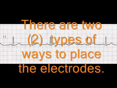 how to apply ecg leads