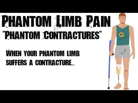how to treat phantom limb pain