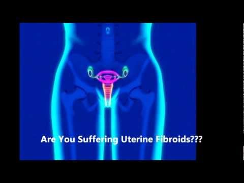 how to cure uterus infection