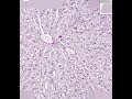 Shotgun Histology Liver