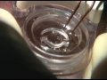 Implantataion of 2 kerarings ICRS for keratoconus - side camera view
