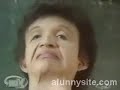 vago deforme