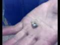 Pulling Teeth
