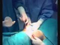 www.cosmetic-surgery-poland.org Breast Enlargement