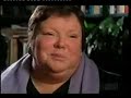 amalgam fillings  in your mouth are poisoning you part 2