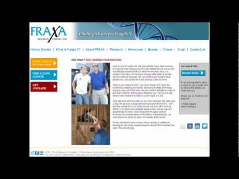 how to treat fragile x syndrome