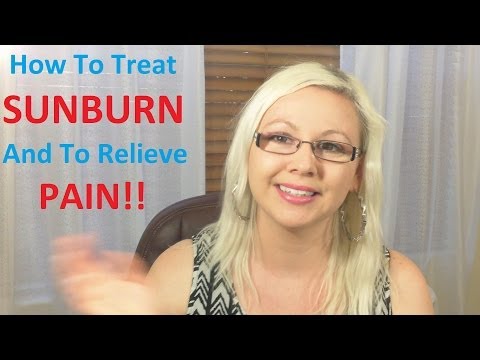 how to relieve itching from a sunburn