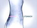 RoC Retinol Anti-Cellulite TV Ad 2008 RoC Retinol Anti-Cellulite TV Ad 2008