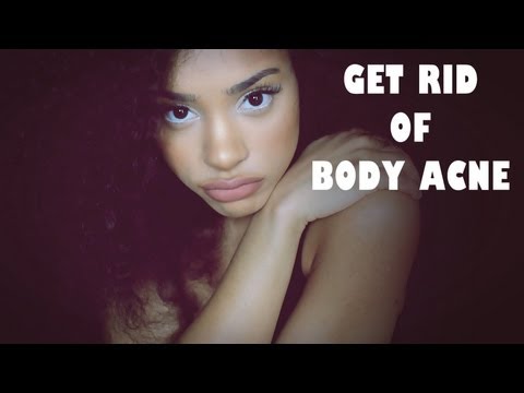 how to cure body acne