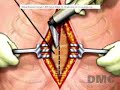 New Surgery Repairs Child\ New Surgery Repairs Child\